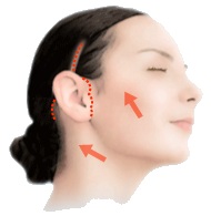 Schnittlegung (Facelifting)