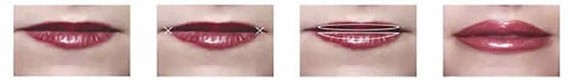 Operationsablauf bei einer Lippenkorrektur