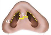 Ablauf bei einer Nasenoperation