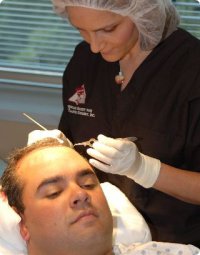 Haarverpflanzung mit der FUE (FUT)-Methode
